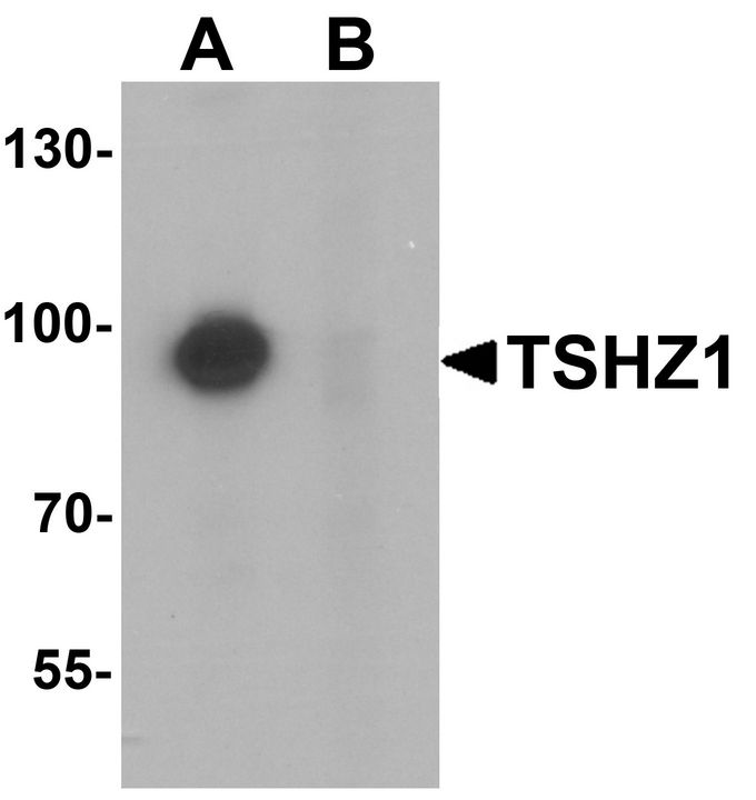 Western blot analysis of TSHZ1 in A-20 cell lysate with TSHZ1 antibody at 1 ug/ml in (A) the absence and (B) the presence of blocking peptide.