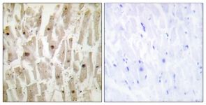 IHC of paraffin-embedded human heart tissue, using TSH1 Antibody. The sample on the right was incubated with synthetic peptide.