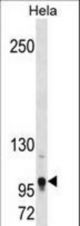Mouse Tshz1 Antibody western blot of HeLa cell line lysates (35 ug/lane). The Mouse Tshz1 antibody detected the Mouse Tshz1 protein (arrow).