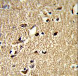 Formalin-fixed and paraffin-embedded human brain tissue reacted with SDCCAG33 Antibody , which was peroxidase-conjugated to the secondary antibody, followed by DAB staining. This data demonstrates the use of this antibody for immunohistochemistry; clinical relevance has not been evaluated.