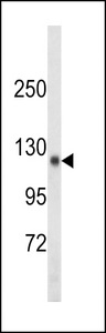 Western blot of SDCCAG33 Antibody in mouse kidney tissue lysates (35 ug/lane). SDCCAG33 (arrow) was detected using the purified antibody.