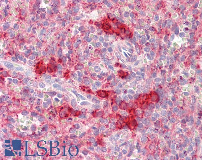 Anti-TSHZ2 antibody IHC staining of human spleen. Immunohistochemistry of formalin-fixed, paraffin-embedded tissue after heat-induced antigen retrieval.