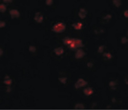 Immunofluorescence of TSHZ2 in A20 cells with TSHZ2 antibody at 20 ug/ml.