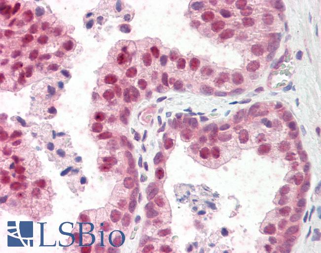 Anti-TSHZ3 antibody IHC staining of human prostate. Immunohistochemistry of formalin-fixed, paraffin-embedded tissue after heat-induced antigen retrieval.