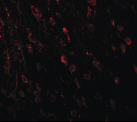 Immunofluorescence of TSHZ3 in mouse brain tissue with TSHZ3 antibody at 20 ug/ml.