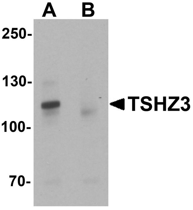 Western blot analysis of TSHZ3 in mouse brain tissue lysate with TSHZ3 antibody at 1 ug/ml in (A) the absence and (B) the presence of blocking peptide.