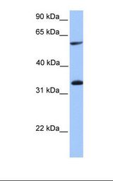 Placenta lysate. Antibody concentration: 1.0 ug/ml. Gel concentration: 12%.