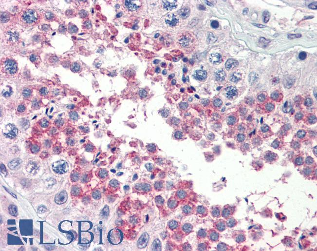 Anti-TSKS antibody IHC of human testis. Immunohistochemistry of formalin-fixed, paraffin-embedded tissue after heat-induced antigen retrieval. Antibody LS-B3570 concentration 5 ug/ml.