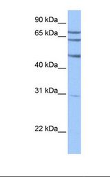 HepG2 cell lysate. Antibody concentration: 1.0 ug/ml. Gel concentration: 12%.