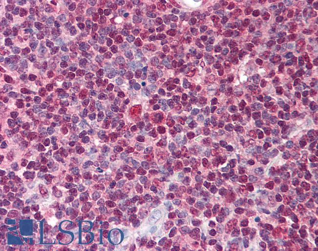 Anti-TSLP antibody IHC of human thymus. Immunohistochemistry of formalin-fixed, paraffin-embedded tissue after heat-induced antigen retrieval. Antibody LS-B614 concentration 5 ug/ml.