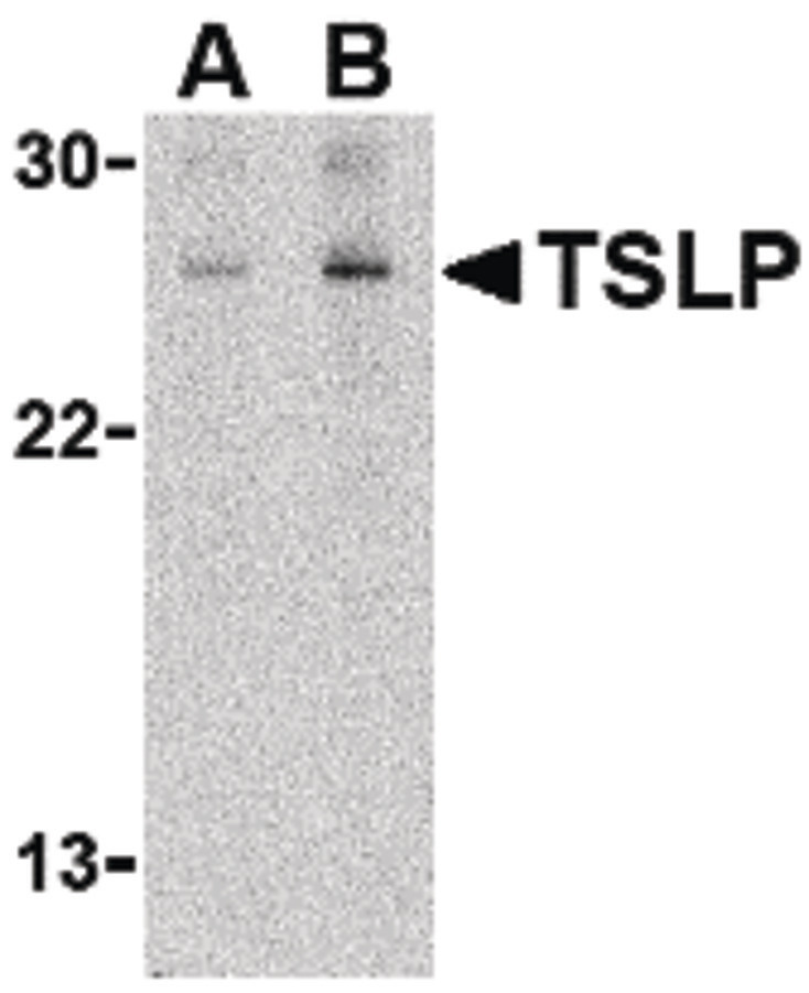 Western blot of TSLP in Jurkat cell lysate with TSLP antibody at (A) 1 and (B) 2 ug/ml.