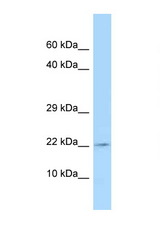 TSLP antibody LS-C145989 Western blot of MCF7 Cell lysate. Antibody concentration 1 ug/ml.