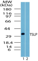 Western blot of TSLP in HL60 cell lysate in the 1) absence and 2) presence of immunizing peptide using LS-C148343 at 2 ug/ml.