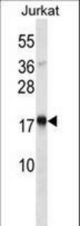 TSLP Antibody western blot of Jurkat cell line lysates (35 ug/lane). The TSLP antibody detected the TSLP protein (arrow).