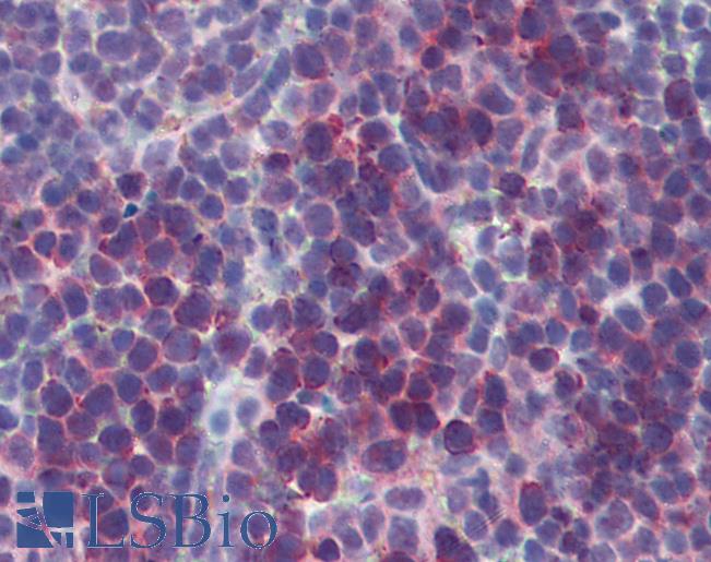 Anti-TSLP antibody IHC of mouse spleen. Immunohistochemistry of formalin-fixed, paraffin-embedded tissue after heat-induced antigen retrieval. Antibody LS-B3640 concentration 5 ug/ml.