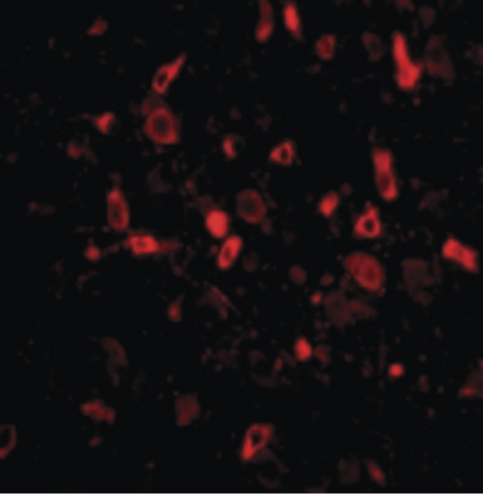 Immunofluorescence of TSLP in Mouse Brain cells with TSLP antibody at 20 ug/ml.