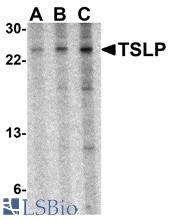 Western blot of TSLP in A-20 cell lysate with TSLP antibody at (A) 0.5, (B) 1 and (C) 2 ug/ml.