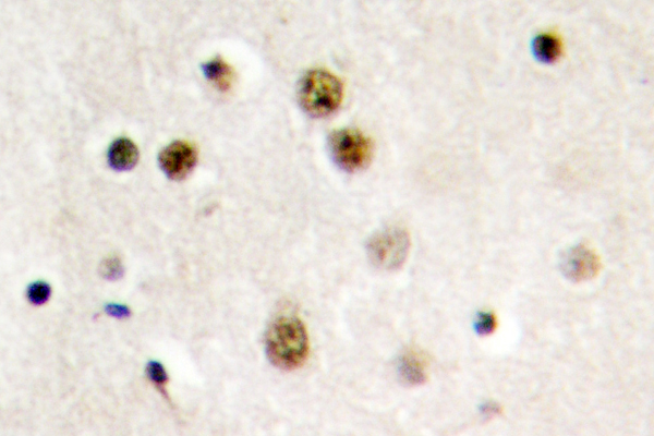 IHC of Translin (E121) pAb in paraffin-embedded human brain tissue.