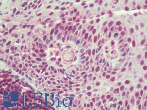 Anti-TSN / Translin antibody IHC staining of human tonsil. Immunohistochemistry of formalin-fixed, paraffin-embedded tissue after heat-induced antigen retrieval.