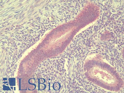 Anti-TSN / Translin antibody IHC staining of human uterus, endometrium. Immunohistochemistry of formalin-fixed, paraffin-embedded tissue after heat-induced antigen retrieval.