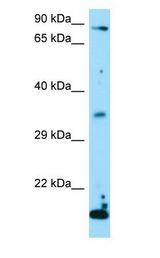 TSNAX / TRAX antibody Western Blot of 293T.