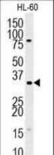 TSNAX Antibody western blot of HL-60 cell line lysates (35 ug/lane). The TSNAX antibody detected the TSNAX protein (arrow).
