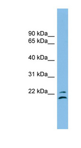 TSPAN1 antibody LS-C116237 Western blot of MCF7 cell lysate.