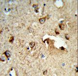 Formalin-fixed and paraffin-embedded human brain tissue reacted with TSPAN1 Antibody , which was peroxidase-conjugated to the secondary antibody, followed by DAB staining. This data demonstrates the use of this antibody for immunohistochemistry; clinical relevance has not been evaluated.