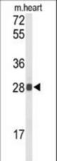 Western blot of TSPAN1 Antibody in mouse heart tissue lysates (35 ug/lane). TSPAN1 (arrow) was detected using the purified antibody.