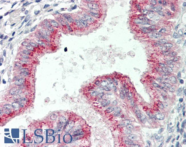 Human Uterus: Formalin-Fixed, Paraffin-Embedded (FFPE)