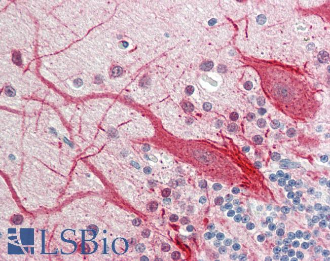 Human Brain, Cerebellum: Formalin-Fixed, Paraffin-Embedded (FFPE)