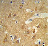Formalin-fixed and paraffin-embedded human brain tissue reacted with TSPAN12 Antibody , which was peroxidase-conjugated to the secondary antibody, followed by DAB staining. This data demonstrates the use of this antibody for immunohistochemistry; clinical relevance has not been evaluated.