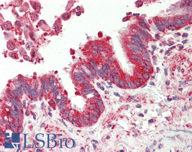 Anti-TSPAN12 antibody IHC staining of human lung, respiratory epithelium. Immunohistochemistry of formalin-fixed, paraffin-embedded tissue after heat-induced antigen retrieval. Antibody LS-B9720 concentration 5 ug/ml.