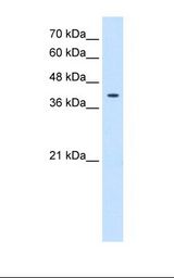 HepG2 cell lysate. Antibody concentration: 0.25 ug/ml. Gel concentration: 12%.