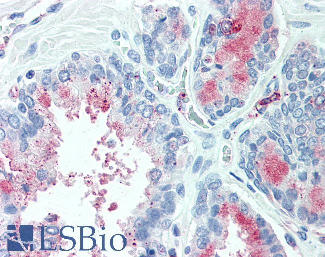 Anti-TSPAN13 antibody LS-A8853 IHC of human prostate. Immunohistochemistry of formalin-fixed, paraffin-embedded tissue after heat-induced antigen retrieval.