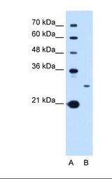 Lane A: Marker. Lane B: HepG2 cell lysate. Antibody concentration: 1.0 ug/ml. Gel concentration: 12%.