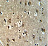 UPK1B Antibody IHC of formalin-fixed and paraffin-embedded brain tissue followed by peroxidase-conjugated secondary antibody and DAB staining.