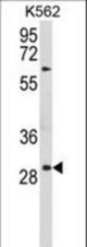 Western blot of UPK1B Antibody in K562 cell line lysates (35 ug/lane). UPK1B (arrow) was detected using the purified antibody.