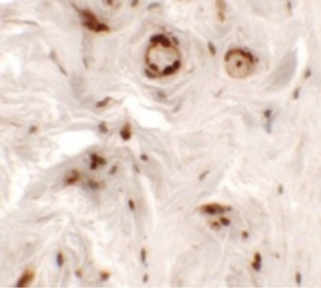 Immunohistochemistry of UPK1B in human bladder tissue with UPK1B antibody at 5 ug/ml.