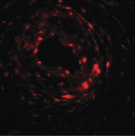 Immunofluorescence of UPK1B in human bladder muscle tissue with UPK1B antibody at 20 ug/ml.