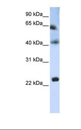 Hela cell lysate. Antibody concentration: 1.0 ug/ml. Gel concentration: 12%.