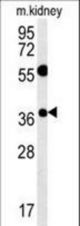 TSPAN3 Antibody western blot of mouse kidney tissue lysates (15 ug/lane). The TSPAN3 antibody detected TSPAN3 protein (arrow).