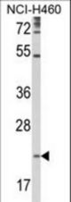 Western blot of TSPAN31 Antibody in NCI-H460 cell line lysates (35 ug/lane). TSPAN31 (arrow) was detected using the purified antibody.(2 ug/ml)