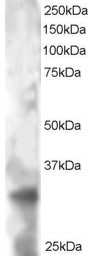 Antibody staining (2 ug/ml) of HeLa lysate (RIPA buffer, 30 ug total protein per lane). Primary incubated for 12 hour. Detected by Western blot of chemiluminescence.