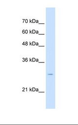 HepG2 cell lysate. Antibody concentration: 2.5 ug/ml. Gel concentration: 12%.
