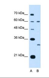 Lane A: Marker. Lane B: Jurkat cell lysate. Antibody concentration: 5.0 ug/ml. Gel concentration: 12%.