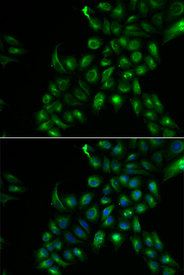 Immunofluorescence analysis of U2OS cell using TSPAN7 antibody. Blue: DAPI for nuclear staining.