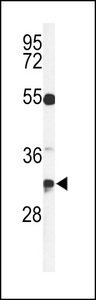 Western blot of TSPAN7 Antibody in CEM cell line lysates (35 ug/lane). TSPAN7 (arrow) was detected using the purified antibody.