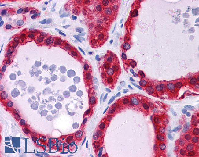 Anti-TSPAN9 antibody IHC of human thyroid. Immunohistochemistry of formalin-fixed, paraffin-embedded tissue after heat-induced antigen retrieval. Antibody LS-B5067 concentration 5 ug/ml.