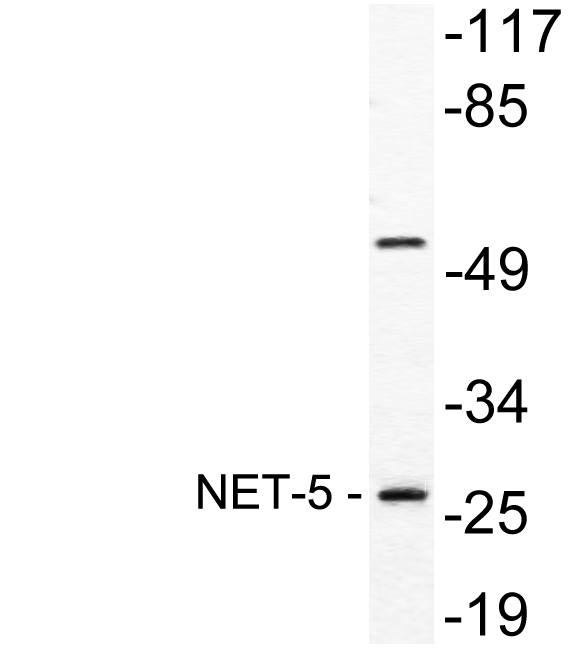 Western blot of NET-5 antibody in extracts from A549 cells.